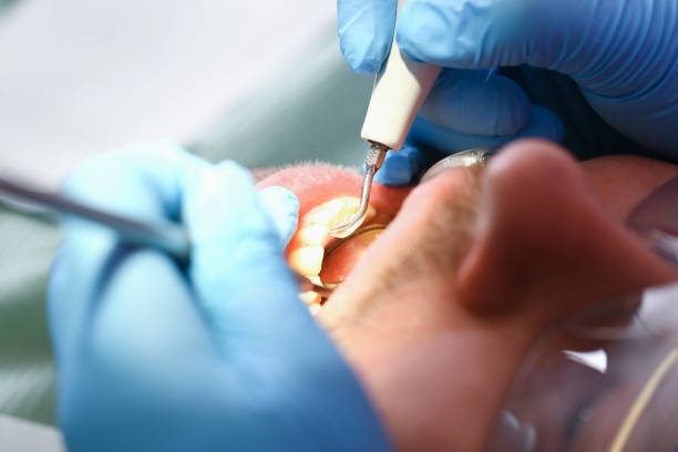 Best Emergency Tooth Extraction  in Cinco Ranch, TX